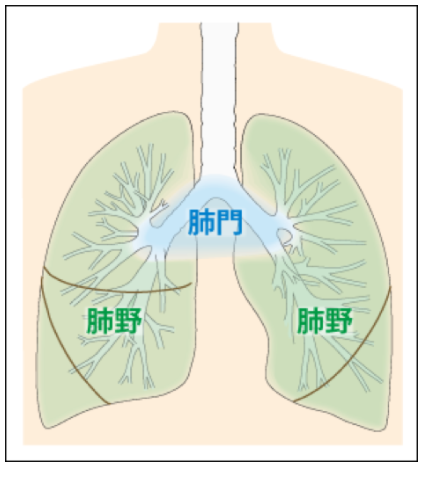 肺がんとは 北青山dクリニック