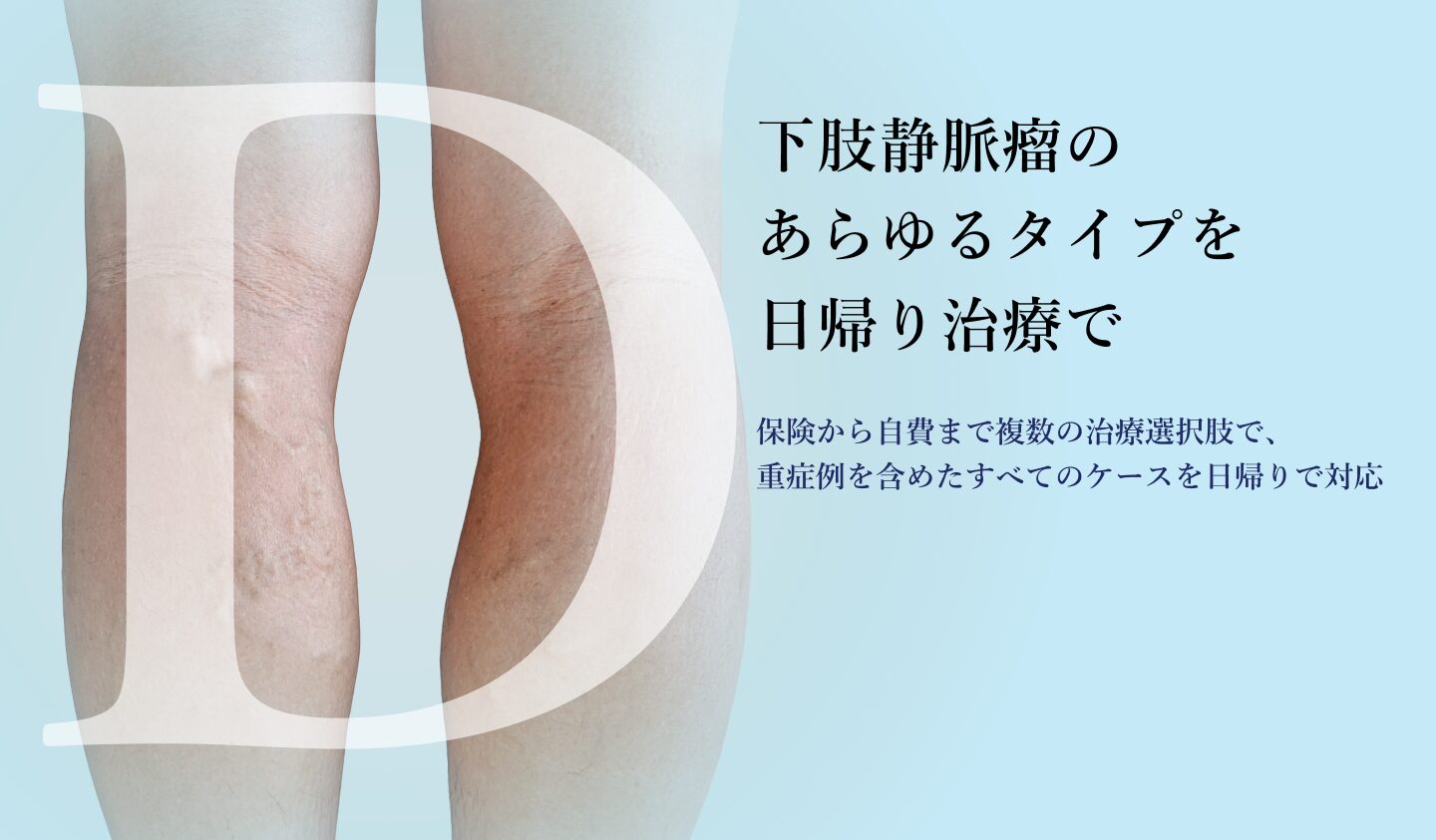 下肢静脈瘤レーザー治療